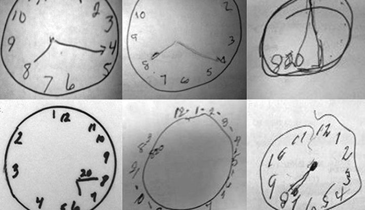 Efficacy of Paper-based Cognitive Training in Vietnamese Patients With Early Alzheimer's Disease